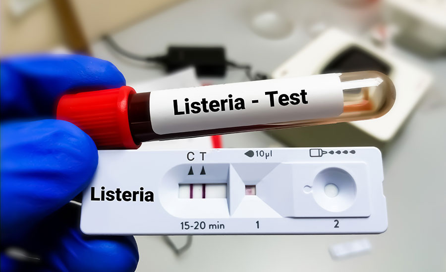 Listeria bacteria tube test